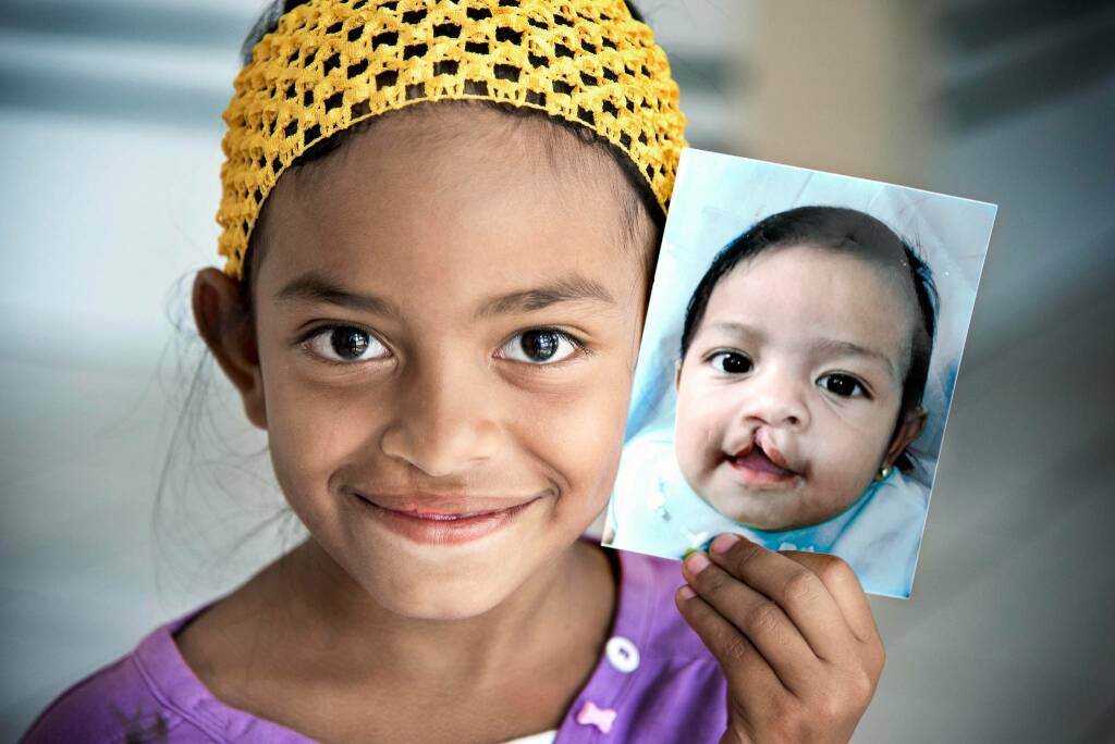 Bimbi all'aperto? Niente paura con i braccialetti anti-smarrimento di  Operation Smile