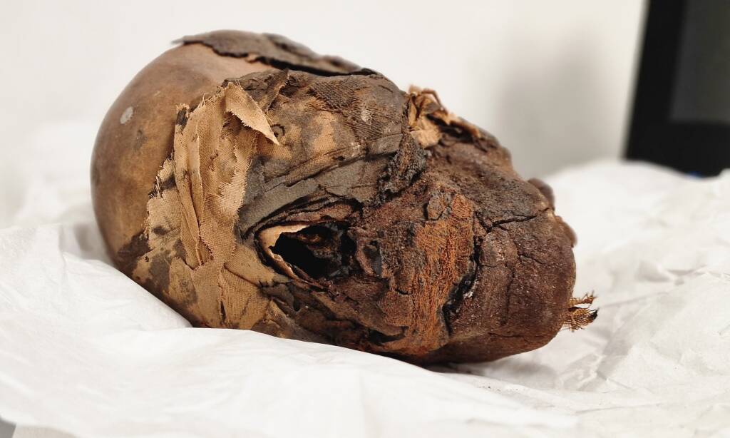 Le mummie del Museo Civico Archeologico di Erba - Le analisi